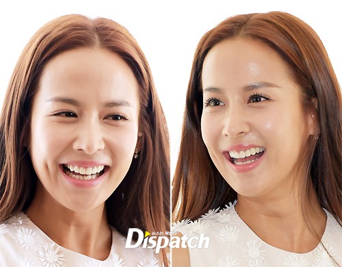 보조개 이미지