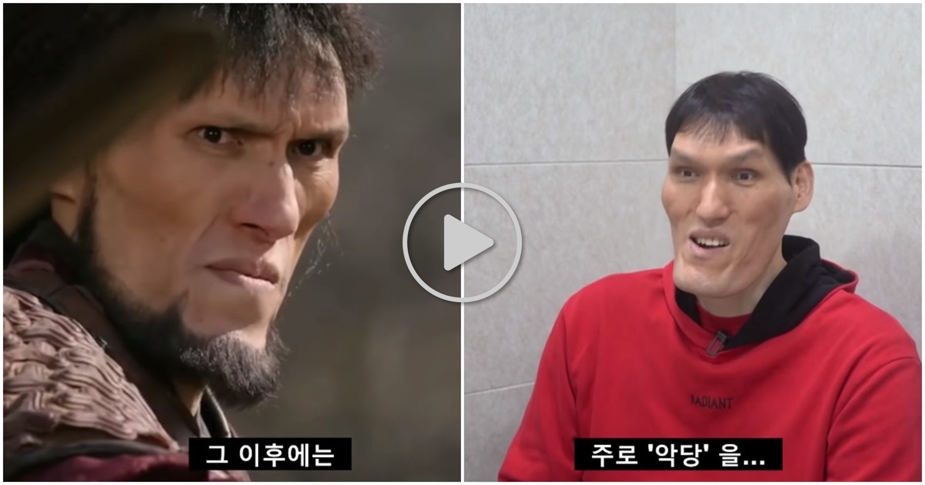 “The forehead and chin protrudes like a giant…”‘Tall 208cm’ Seo Chan-ho, confessing the aftereffects of acromegaly